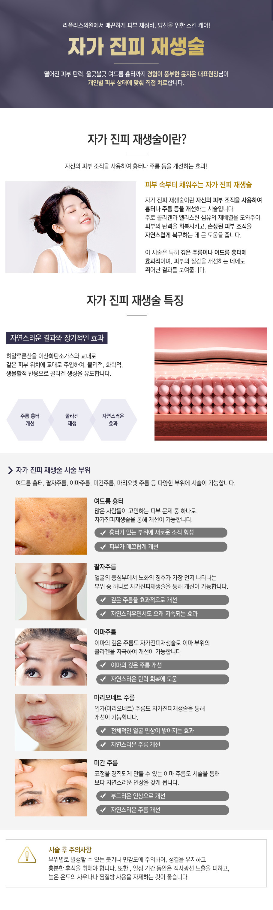 이미지명