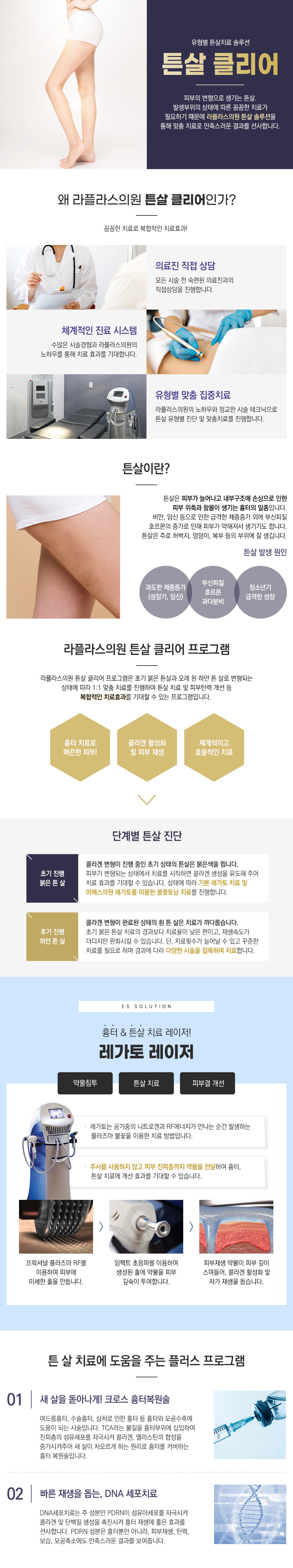튼살