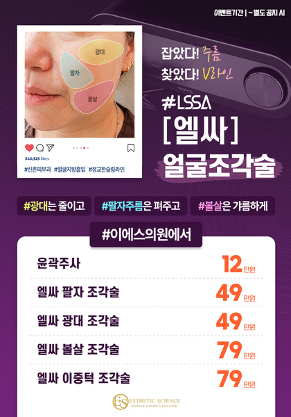 엘싸 얼굴 조각술 이벤트!